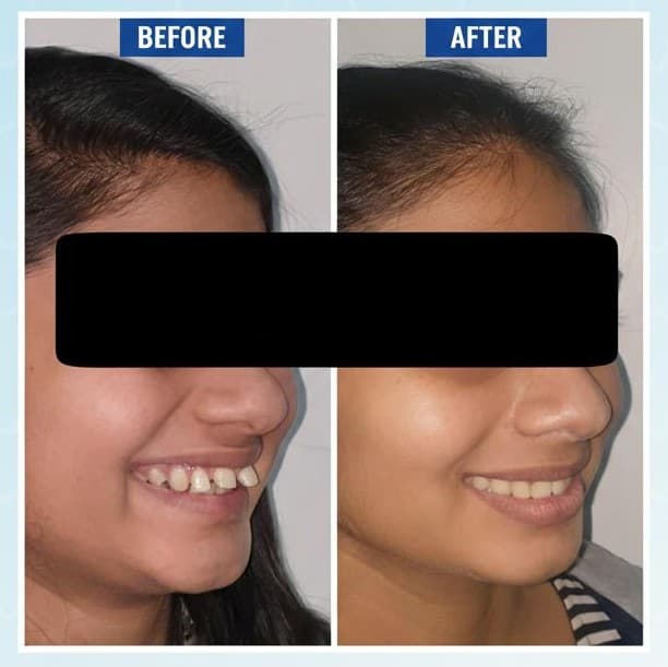 Orthodontics